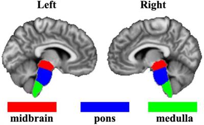 Frontiers | Increased Functional Connectivity Between Medulla and